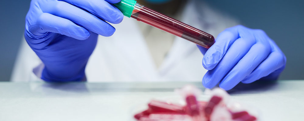 Blood Tests